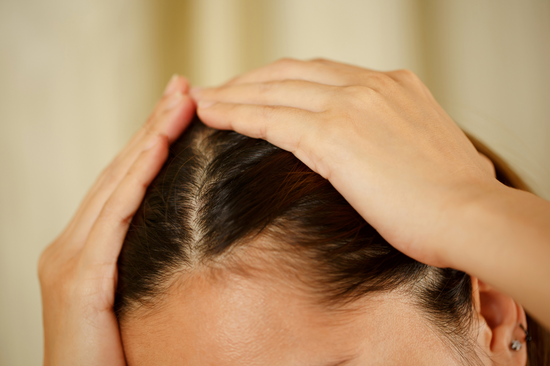 3 Möglichkeiten, wie PCOS Ihre Haut, Haare und Ihr allgemeines Wohlbefinden beeinträchtigen könnte