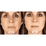 CurrentBody Skin RF Radiofrequenz Hautstraffungsgerät in Limitierter Edition